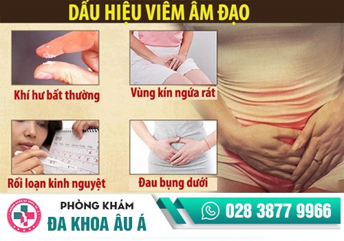 viêm âm đạo